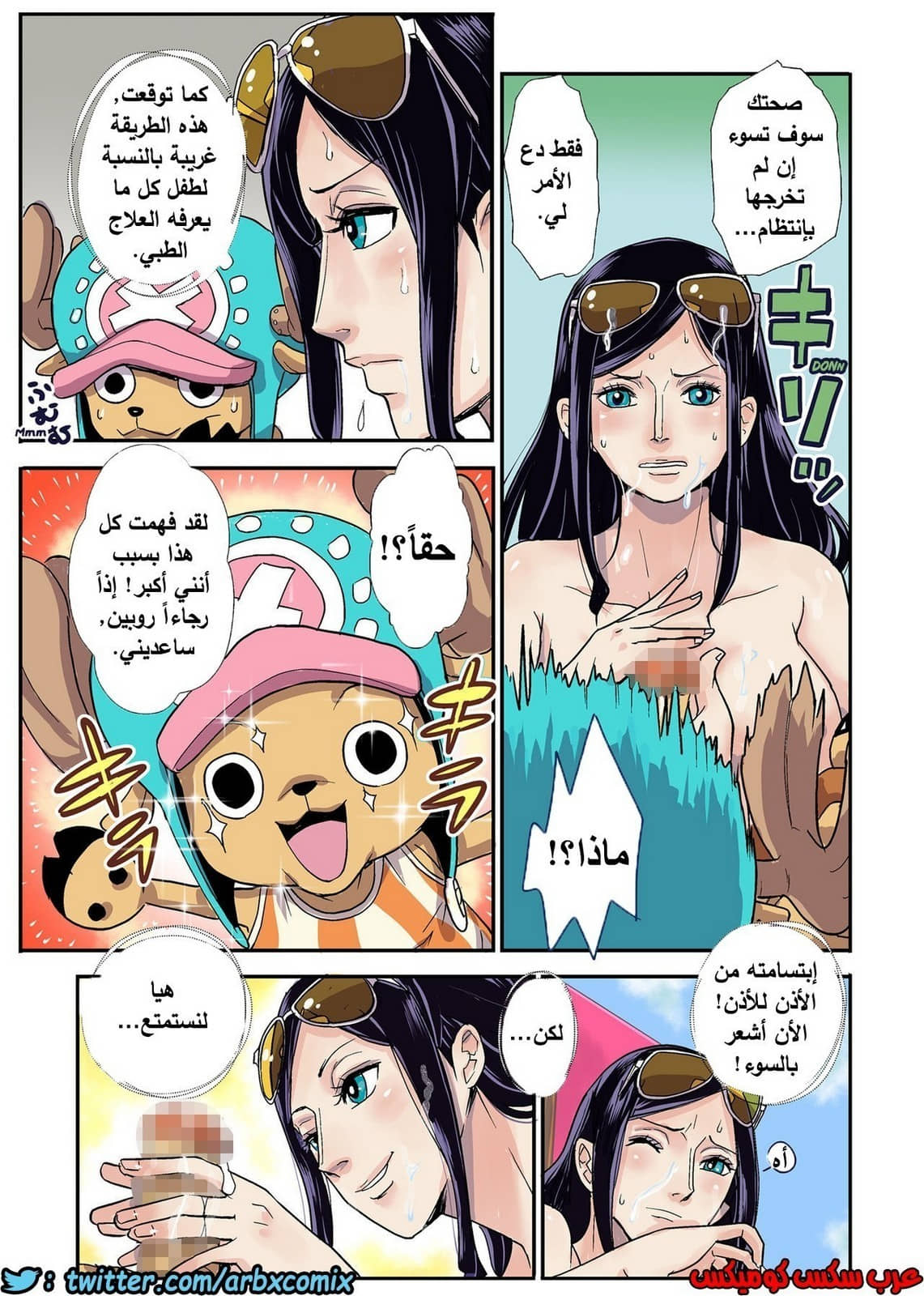 534 إنتصاب تشوبر الجزء 1 534 إنتصاب تشوبر الجزء 1